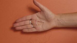 Ketimpangan Peran dalam Kontrasepsi : Mengapa Selalu Diletakkan Kepada Perempuan?